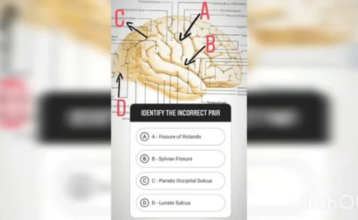 Texas Tech Anatomy Questions: Practice for Success Today